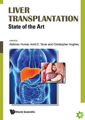 Liver Transplantation: State Of The Art